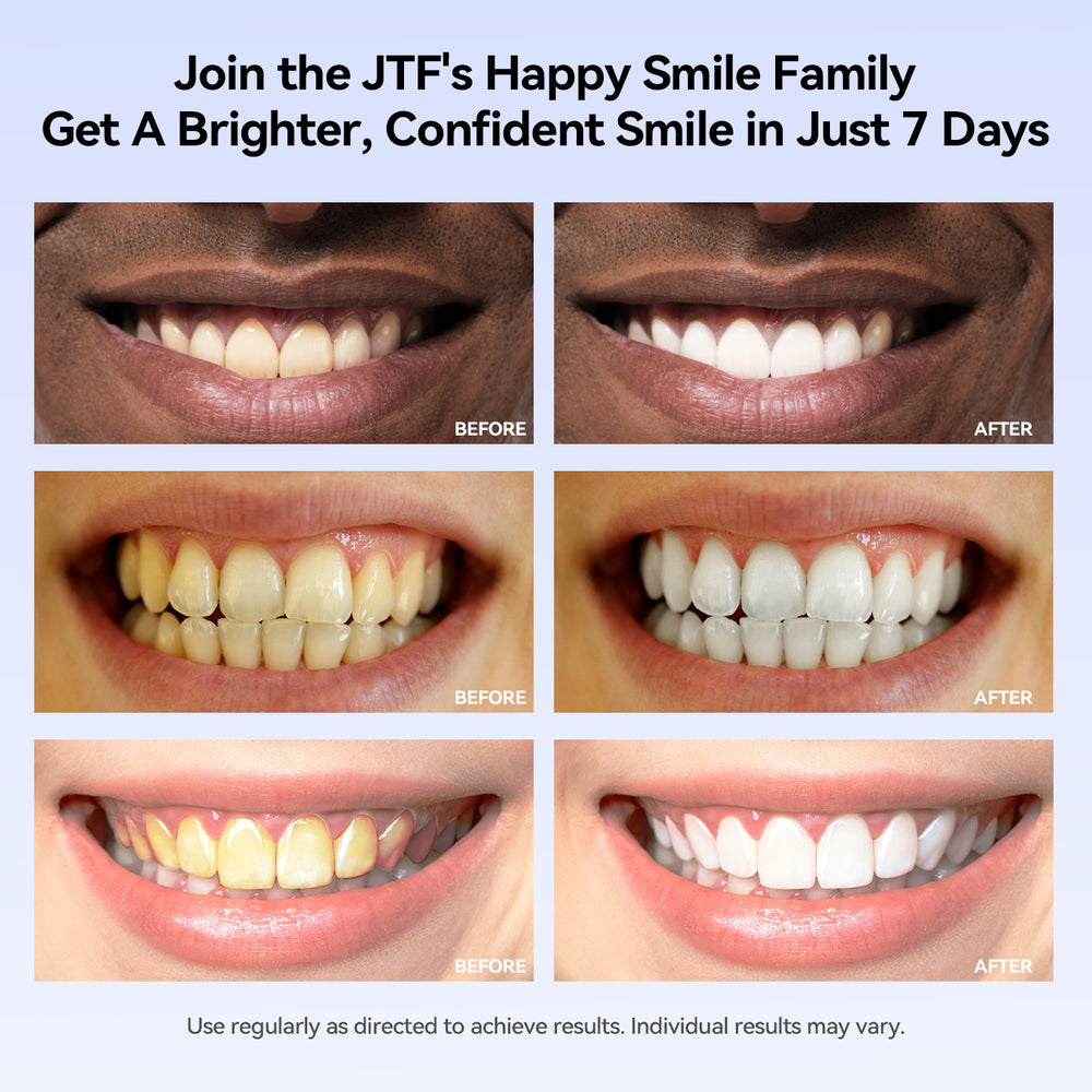 Pro Teeth Whitening Bundle